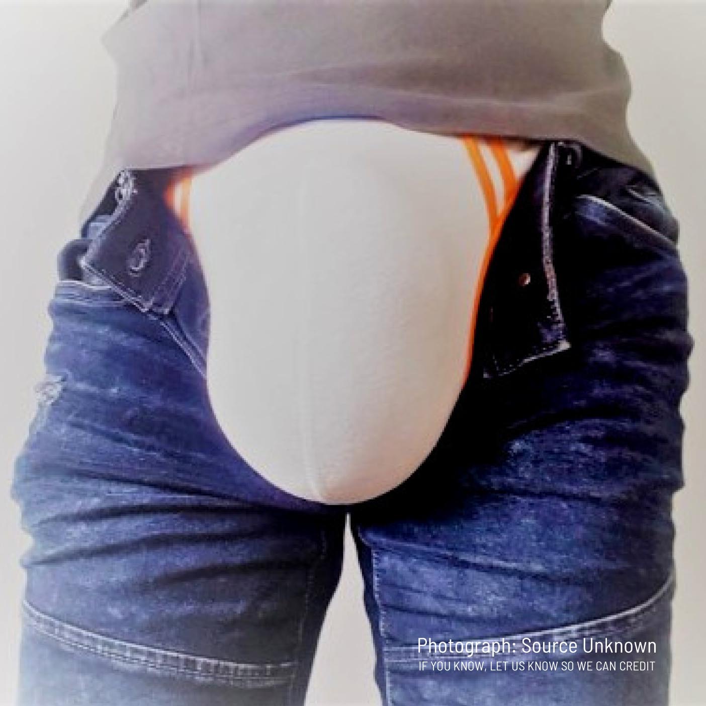 Saline injections (balls)